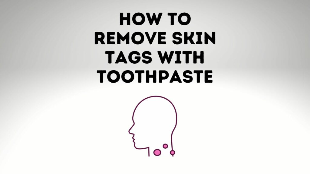 How To Remove Skin Tags With Toothpaste? Power Tooth Paste