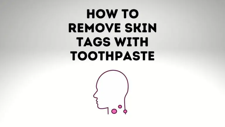 How To Remove Skin Tags With Toothpaste