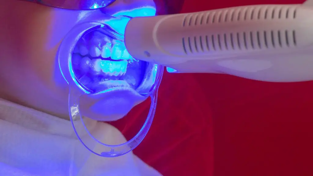 Is UV Teeth Whitening Safe?