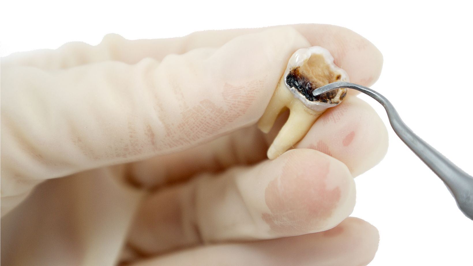 Can Natural Toothpaste Cause Cavities? Power Tooth Paste