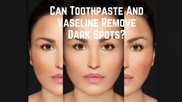 Can Toothpaste And Vaseline Remove Dark Spots?